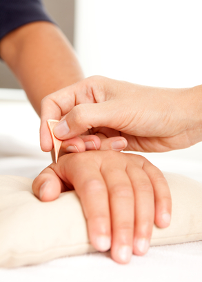 סו ג'וק ביד דיקור בעזרת מחט ביד